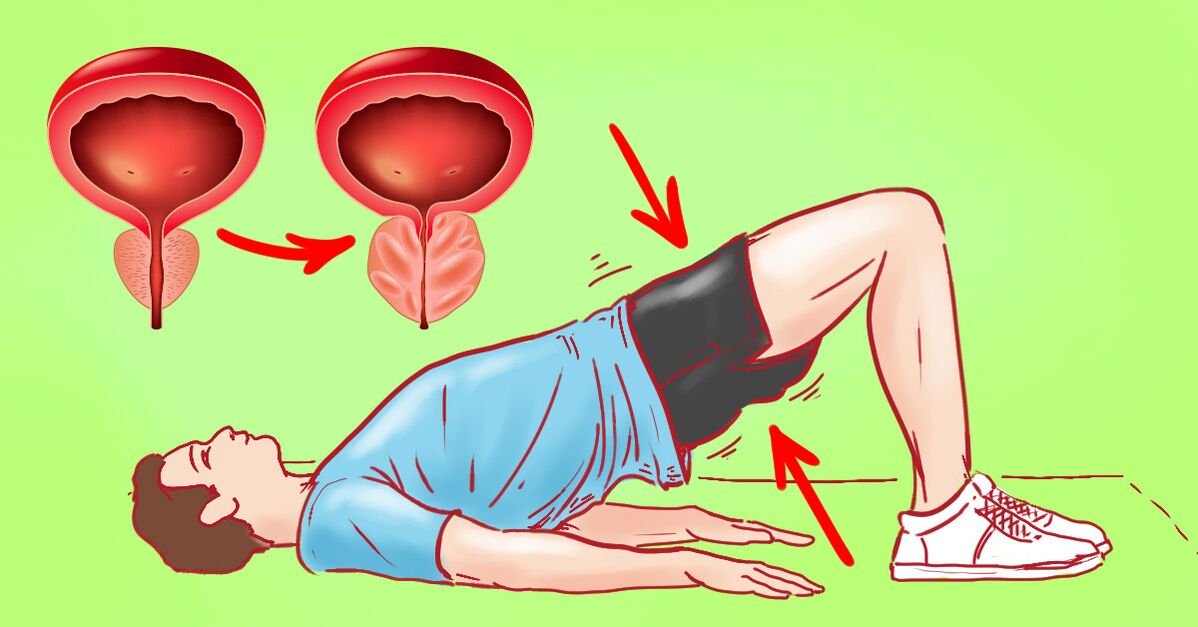 Therapeutic exercises for chronic prostatitis. 